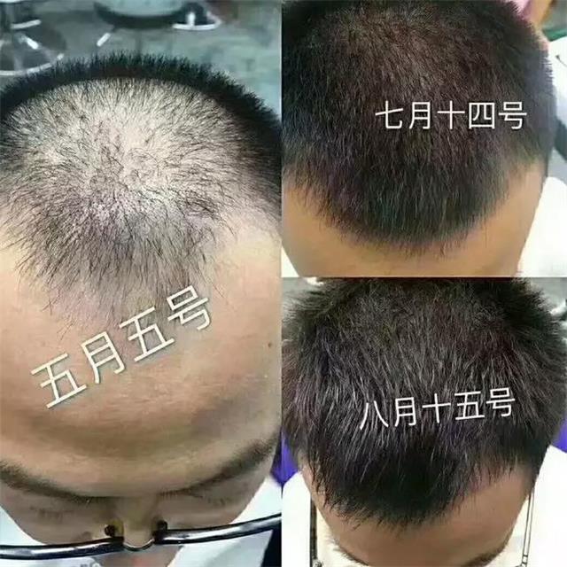 养发馆加盟